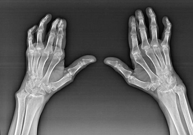 Diagnosis of fingertips