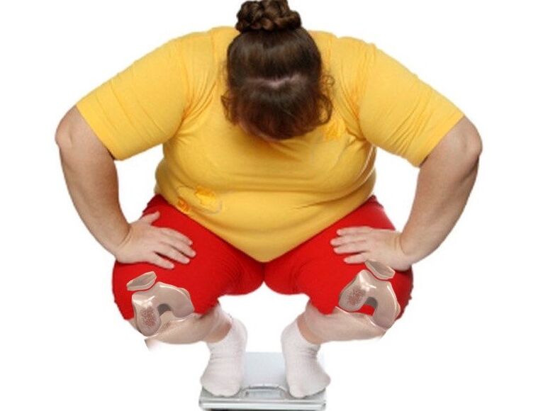 Among patients suffering from osteoarthritis, the majority are overweight or obese